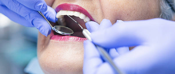 Best Emergency Dentist for Lost Fillings or Crowns in Byron, IL